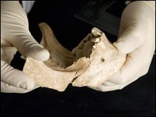 esqueletos decapitados de vikingos _47457245_4.teethselectedforisotopeanalysis