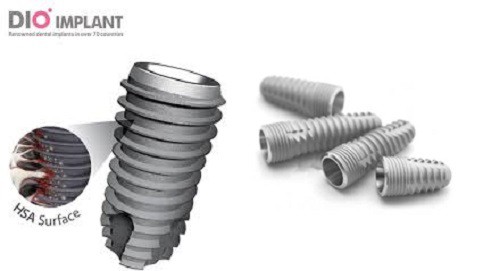 Trồng răng implant và những lợi ích Cac-loai-tru-implant-nha-khoa-hien-nay-4