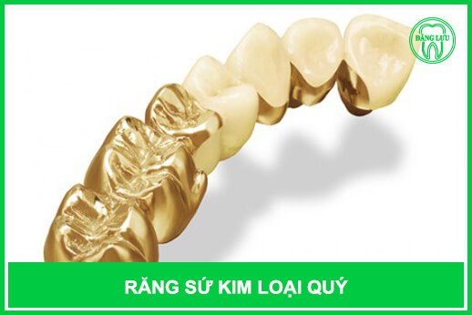 Tác dụng của răng sứ Rang-su-kim-loai-quy-2