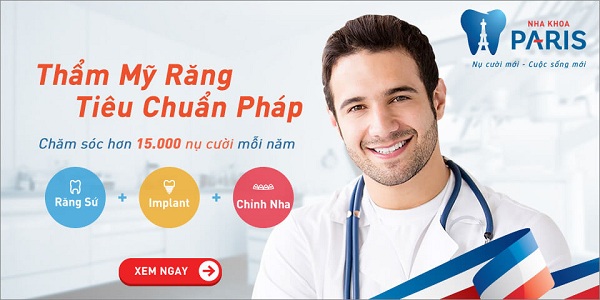 Niềng răng hô giá bao nhiêu – Niềng răng UY TÍN ở đâu? Gioi-thieu-1