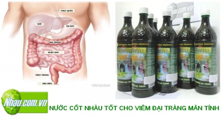 http://nhau.com.vn/uploads/products/norms/1366696824_Viem-dai-trang-man-tinh-nuoc-cot-nhau-noni-juice-chua-benh-tieu-hoa-viem-dai-trang.jpg