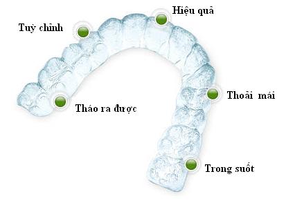 Niềng răng trong suốt có đau không? Nieng-rang-trong-suot-co-dau-khong-01