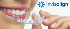 Những cải tiến mới của khí cụ invisalign Nhung-cai-tien-moi-cua-khi-cu-invisalign-300x127