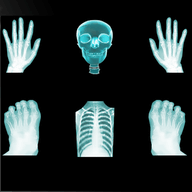 افضل برامج نوكيا اشا لعام  2014 X-Ray-Scanner