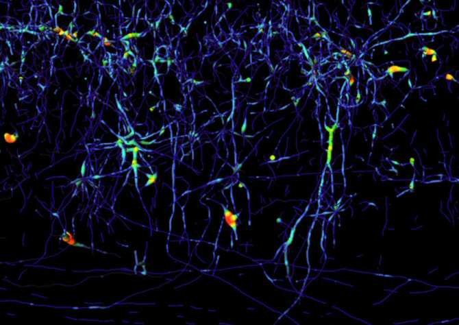 Hacer transparente la medula espinal, gran avance para investigar su regeneración  Img_6580