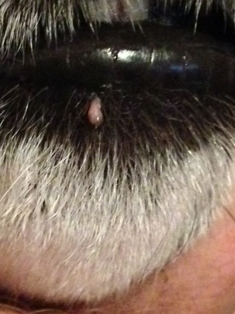 Strange Wart/Skin Tag 1sdqo6