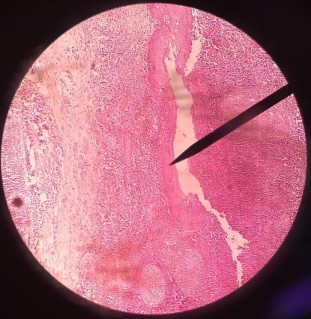 Tejido sanguíneo-hematopoyetico y linfoide (presentado por Daniela Chamorro Caballero) IIB  2mdgv3n