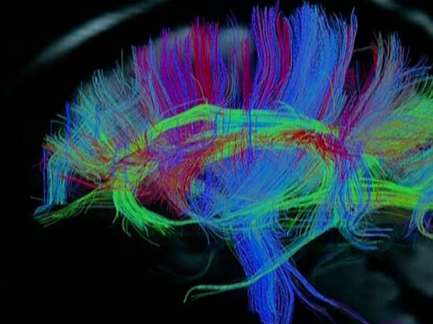 Cientistas desenvolvem exame para mapeamento do cérebro Estudo-exame-cerebro-bbc