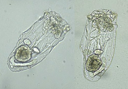 Qu'est-ce qu'un Rotifère ? Asplanchna_1