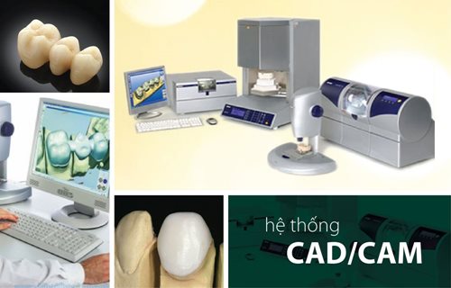 Quy trình bọc răng sứ Cerec3