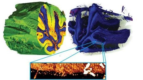 Nouvelles images du cerveau 1058768