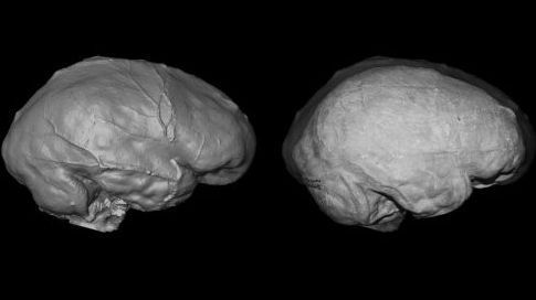 le cerveau humain s’est recroquevillé 1291457