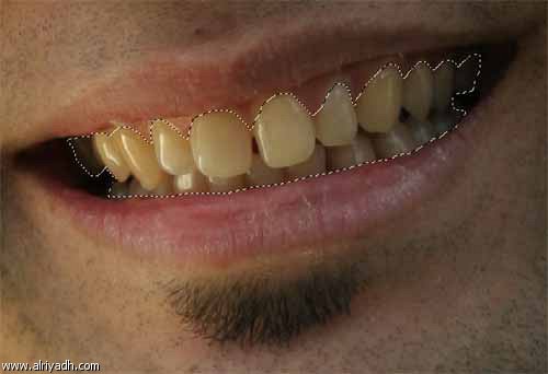 نصائح و وصايا لأسنان أفضل  740562788582
