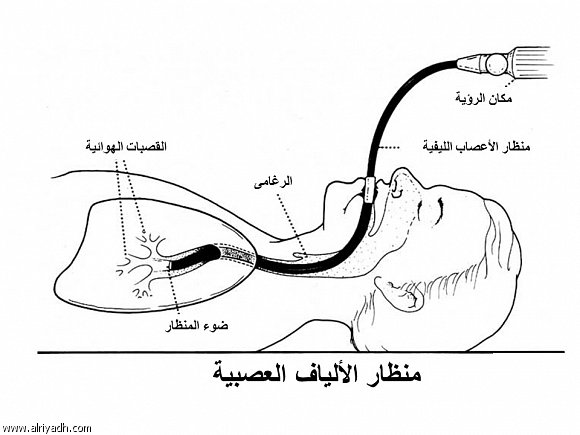  منظار القصبات الهوائية.. سهّل عملية التشخيص والعلاج وقلّل من التدخل الجراحي 270342895062