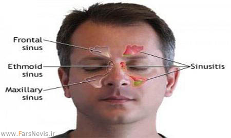 اعضای به درد نخور و بی مصرف در بدن + عکس Sinuses_300x240