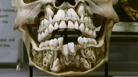 Как режутся зубки или симптомы на зубы... - Страница 2 03d783ada0ef