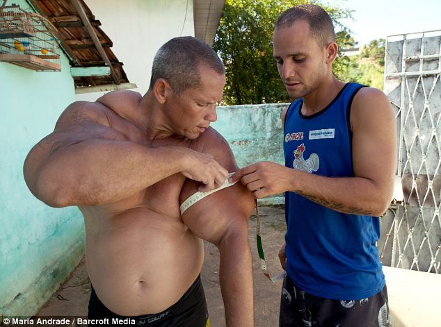 Does anyone else think this is GROSS? -- Bodybuilder Injects Himself With Oil, Alcohol to Grow Giant Muscles Image