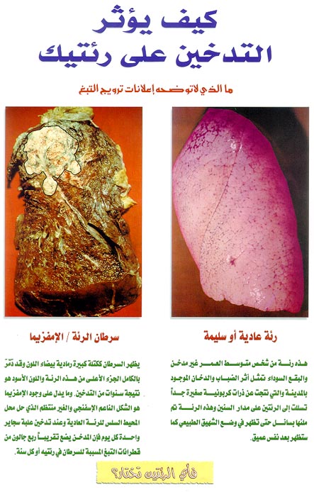 هل تعرف انك تقتل نفسك ايها المدخن ادخل لتعرف لماذا T7