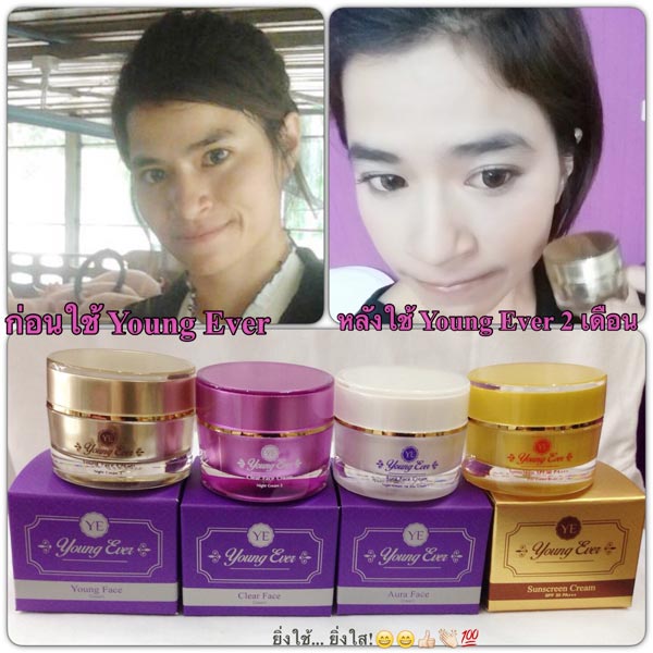 Young Ever Skincare ลดฝ้า กระ จุดด่างดำ รอยดำจากสิว เผยผิวหน้าขาว เงา ใส ไม่โบ๊ะ ไม่กลัวแดด ต้อง Young Ever จ้า!!! 04c29068a43abe1eef344a38c8b4a563