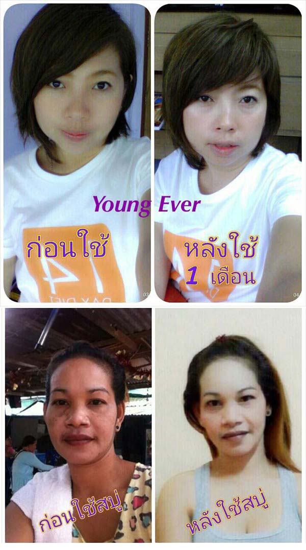 Young Ever Skincare ลดฝ้า กระ จุดด่างดำ รอยดำจากสิว เผยผิวหน้าขาว เงา ใส ไม่โบ๊ะ ไม่กลัวแดด ต้อง Young Ever จ้า!!! B55e778745acfbe48494192b6e99e7f5