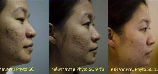 Phyto SC สเต็มเซลจากสวิสเซอร์แลนด์ ที่สุดของความขาวใส ลดเลือนริ้วรอย สรรพคุณครอบ Bbff8b68dac54c102dd3797b21cd0590