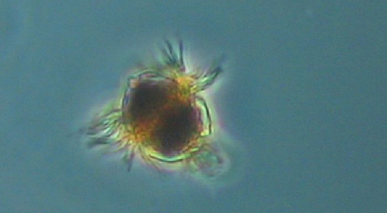 ¿Es un animal? ¿Es una planta? No, es Mesodinium  Ciliate-mesodinium-protozoan