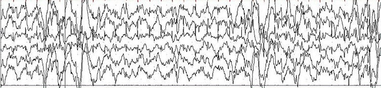 SCP-1237 -  The Epsilon Wave/ε波 1237