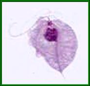 الامراض المعدية Trichomonas1