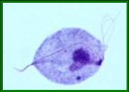 الامراض المعدية Trichomonas2