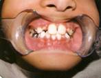     Orthodontics4