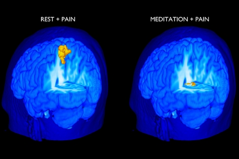 Ocho semanas de meditación pueden cambiar el cerebro. 1302013696_0