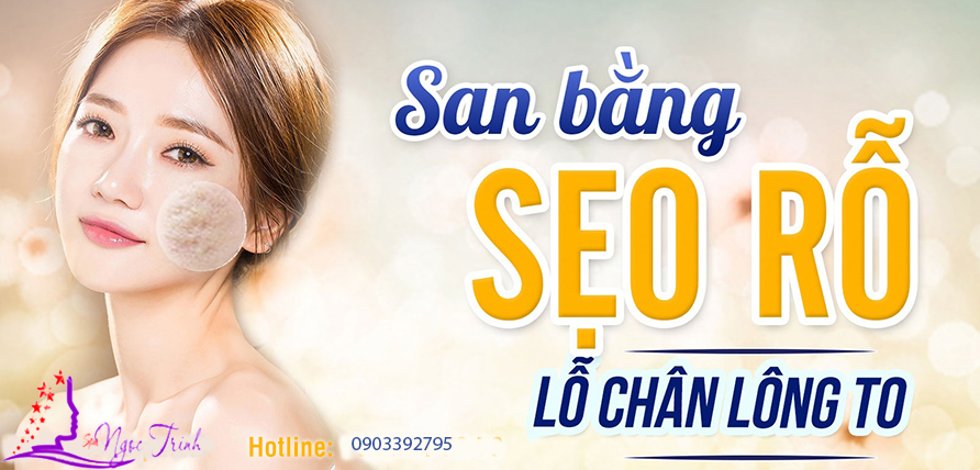 LĂN KIM TRỊ SẸO RỖ CÔNG NGHỆ BELLA HÀN QUỐC Baner_