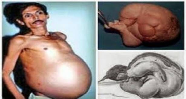بالفيديو: رجل حامل والسبب لا يخطر ببال أحد !! YYYYY-jpg-94625058948742201_589361_large