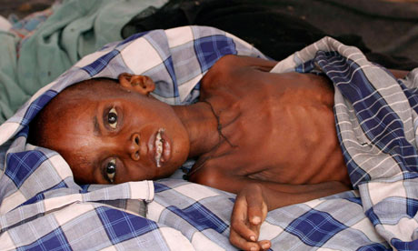 قبل ان يموتو (مجاعة الصومال) Somalia-famine-007