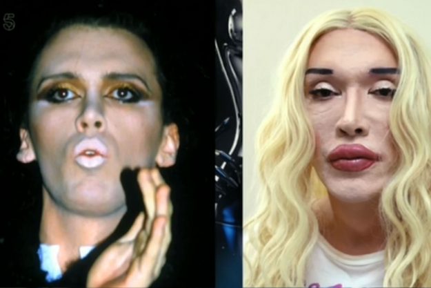 Extreme plastic surgery and celebs addiction to it! 729713_pete_burns_2_084d2f5aeda26c13d3084b77bac5094c