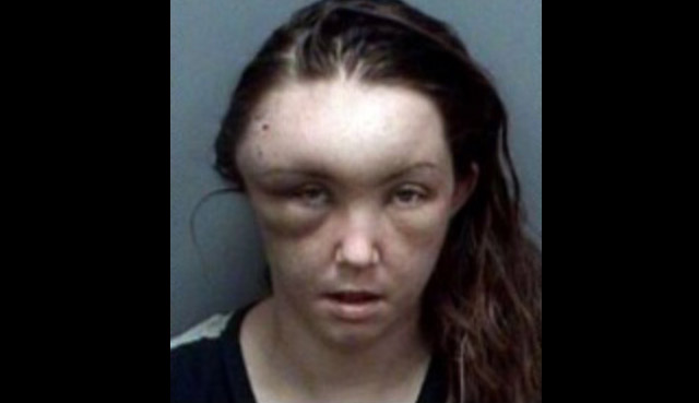 Woman Arrested For Beating Herself Up... Beating-self-up.-640