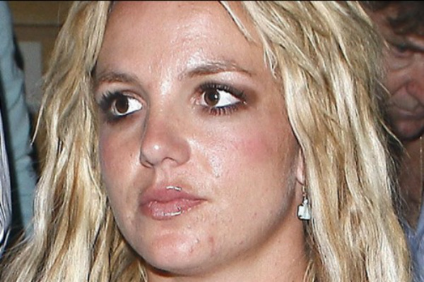 Is Britney growing up? Acne6