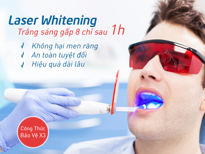 Tẩy trắng răng với giá rẻ siêu chất ư? Tay-trang-rang-gia-bao-nhieu-tien-bang-gia-moi-nhat