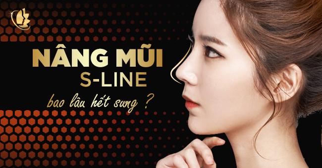 Nâng mũi s line bao lâu hết sưng và đẹp xuất sắc như tự nhiên Nang-mui-s-line-bao-lau-het-sung