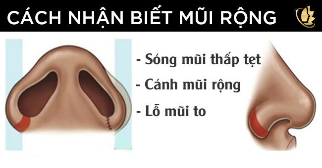  Làm sao cho cánh mũi nhỏ lại? Cach-nhan-biet-mui-rong