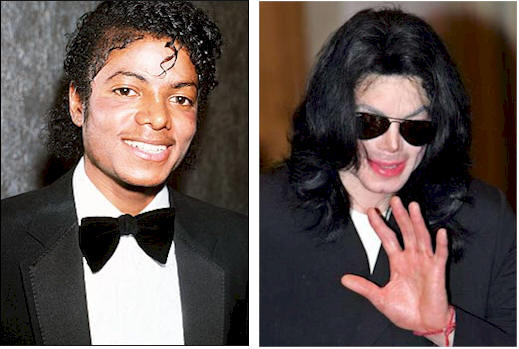 مايكل جاكسون في ذمة الله Michael_jackson_before_and_after