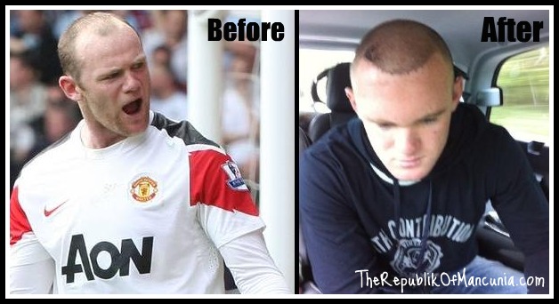 United: Off The Field. - Page 2 Rooney-bald1