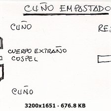 *  ERROR * 10 PESETAS AÑO 1994 "CUÑO EMPASTADO" 82348c38f6fa8f6cabd7d937a1f19dfeo