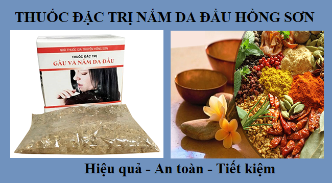 Sức khỏe, đời sống: Thuốc đặc trị nấm da đầu hiệu quả nhất hiện nay Thuoc-dac-tri-nam-da-dau-tot-nhat-hien-nay-1