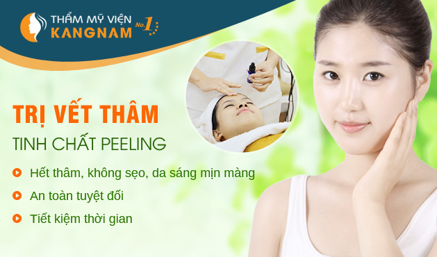 Mách bạn bí quyết trị thâm sau mụn theo dân gian  Tri-vet-tham-bang-cong-nghe-peeling1