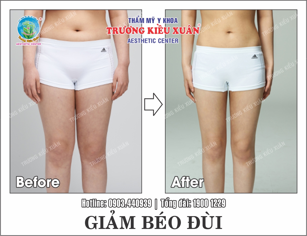 Cách giảm béo đùi nhanh chóng tại nhà  Giam-beo-dui-truoc-sau