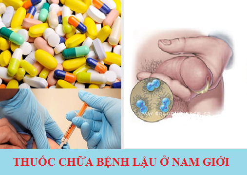 Sức khỏe, đời sống: Thuốc chữa bệnh lậu cho nam giới là gì? Thuoc-chua-benh-lau-o-nam-gioi