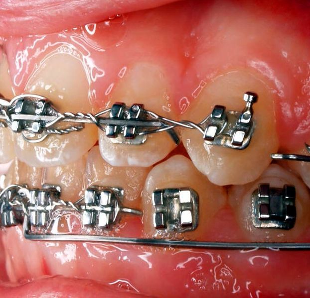 What is the science of orthodontics? 49257_1208471109