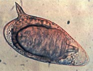 هنا سوف تعرف اشكال الطفيليات بوضوح ان شاء الله Schistosoma_mansoni