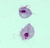 Coacaze pt. cancer, reumatism, sida, risc de AVC si alte boli favorizate de trichomonade Trichomonas_Giemsa_DPDx